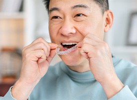 A man putting Invisalign trays in his mouth